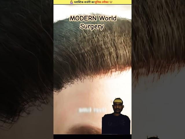 HAIR RESTORATION | Modern World Surgery #education #shorts #greenscreen #reactionvideo #reaction