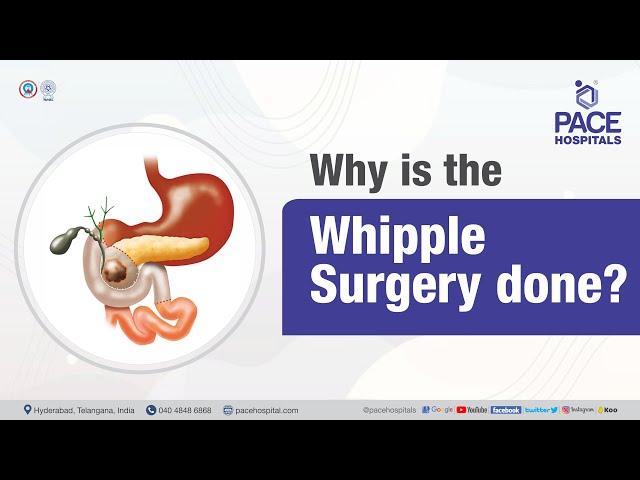 Why is the Whipple Surgery done? | PACE Hospitals #shortvideo #whippleprocedure #pancreaticcancer