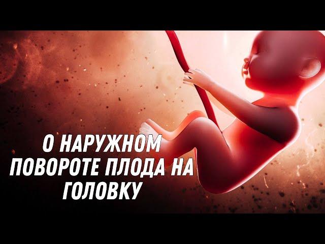 О наружном повороте плода на головку #doctorberezovska #olenaberezovska #беременность