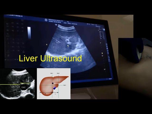 How to scan the Liver -Dr.Ismail Sayed Ismail