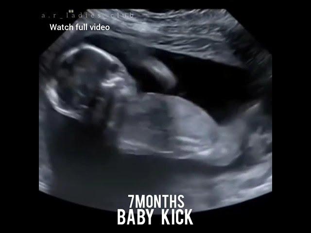 during 7 months pregnancy baby kick #babykicks #babykicking #youtube #shorts #shorts