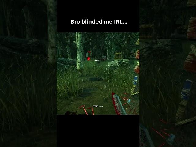 Bro blinded me IRL...