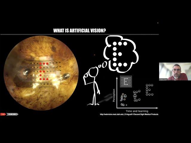 Prof Diego Ghezzi on "Visual prostheses: from the eye to the brain"