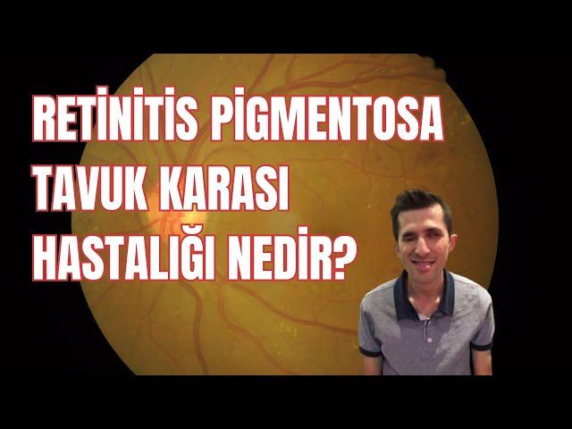 Retinitis Pigmentosa -Tavuk Karası hastalığı nedir, tedavisi var mı? Aktivist Öznur Kırman anlatıyor