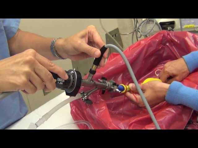 Diagnostic Cystoscopy Model