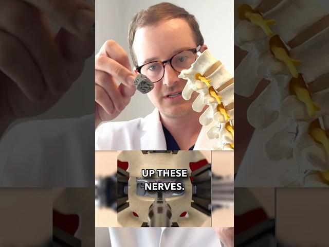 Technology for spine patients (Texan Surgeon Explains)