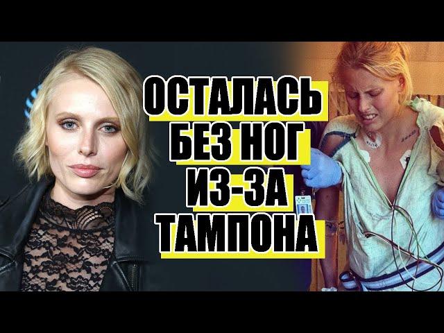 История модели Лорен Вассер, потерявшей ноги из-за тампона