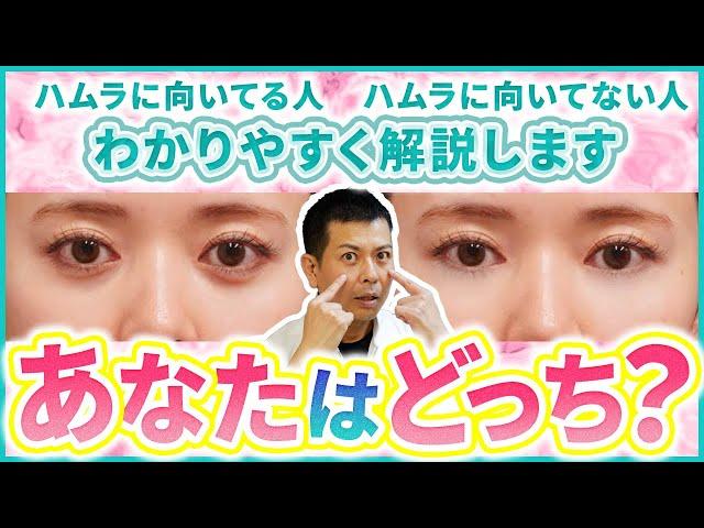 あなたはハムラに向いている？それとも向いていない？日本有数の実力を持つクリニックの症例を用いて詳しく解説します！