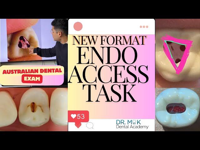 NEW FORMAT! ENDODONTIC ACCESS TASK ADC EXAM