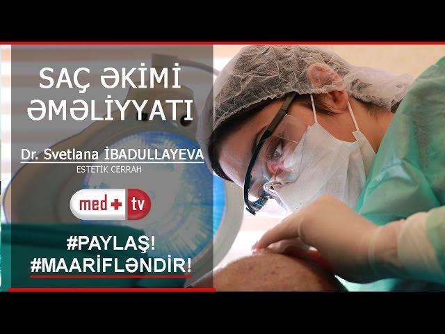 SAÇ TOKULMESİ - SAÇ EKİMİ - DR. Svetlana İBADULLAYEVA Estetik Cerrah MedplusTV