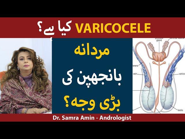 Varicocele Ka Ilaj | Varicocele Treatment at Home in Urdu/Hindi | How To Cure Varicocele?