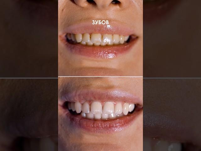 Самая лучшая чистка в мире! Записаться: Тел|Wp 8969 000-40-40 Инстаграм yourclinic.ru