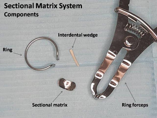 Placement of Sectional Matrix System