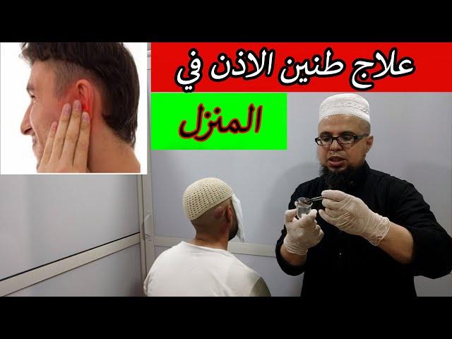 طريقة سهلة لعلاج طنين الاذن في المنزل 00212629926006  \ 00212666426216