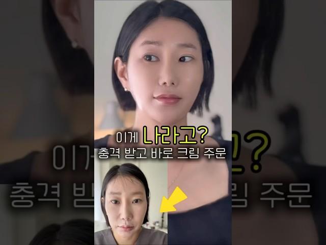 리쥬란 끊게만든 그 크림#세멘잘라이트 #파이토신 #메이크업 #공구 #40대#피부관리