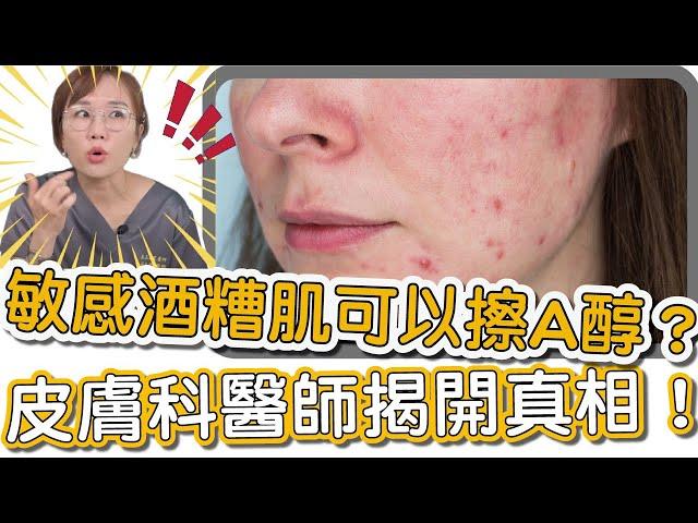 酒糟性肌膚真的能用使用A醇護膚嗎？皮膚科專科醫師莊盈彥來跟你說明！