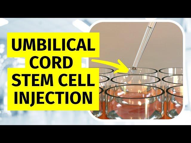 Umbilical Cord Stem Cell Therapy for Knee Arthritis