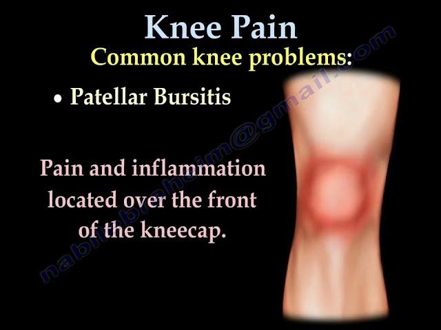 Knee Pain, causes, symptoms, diagnosis and treatment.