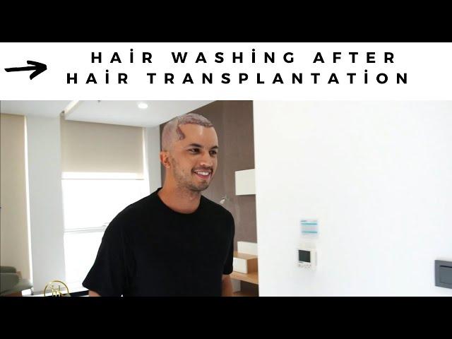 Hair washing after hair transplantation -  Now Hair Time