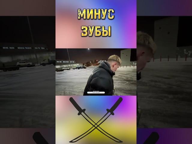 МИНУС ЗУБЫ