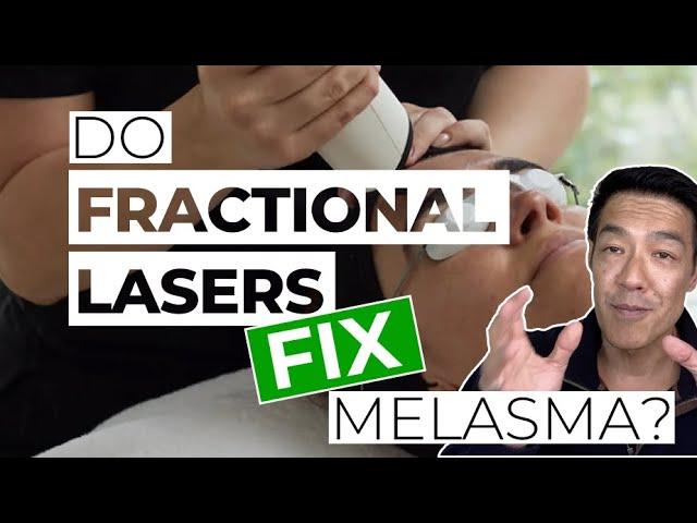 Should you use Fractional Lasers? | Dr Davin Lim