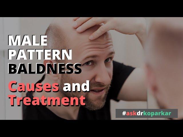 Male Pattern Baldness - Causes & Treatment | Ask Dr. Koparkar