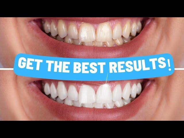 The Ultimate Teeth Whitening Guide | Step-by-Step Instructions for Home Whitening Kits