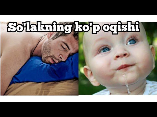 SO'LAKNING KO'P   OQISHI/  КУП СУЛАК ОКИШИ ГИПЕРСАЛИВАЦИЯ