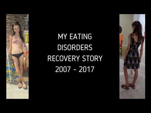 MY ANOREXIA RECOVERY STORY | After 10 years being sick