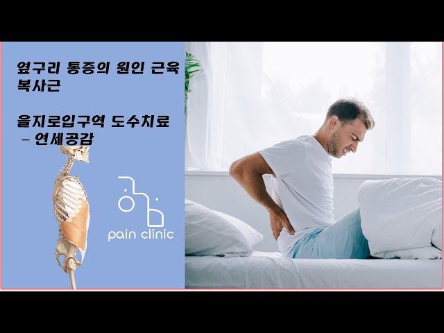 옆구리 통증 원인 근육 복사근 - 시청역 도수치료