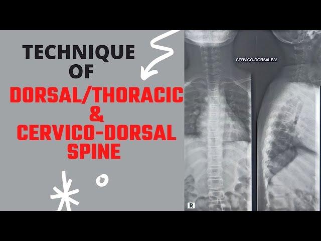 Technique of Dorsal or Thoracic & Cervico Dorsal Spine (Ep-64) | X-ray Cervico thoracic spine