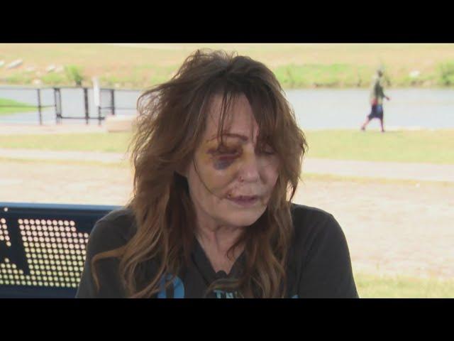 Woman recounts altercation with Fort Worth officers, says she has bruises "everywhere"