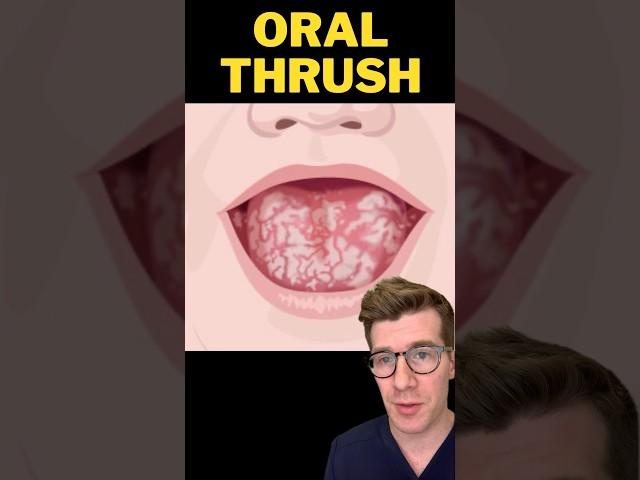 Doctor explains ORAL THRUSH in babies #shorts