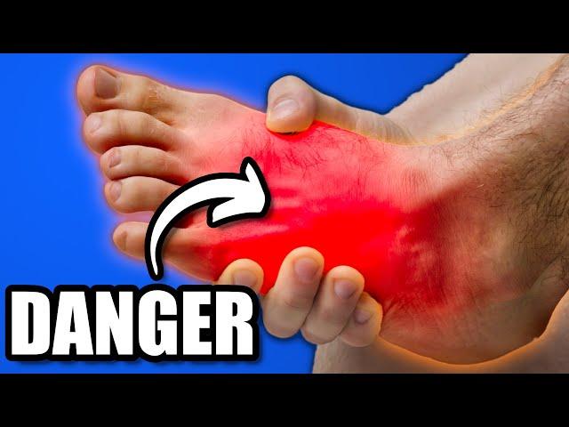 Foot Doctor Explains Sudden Foot Pain After Exercise