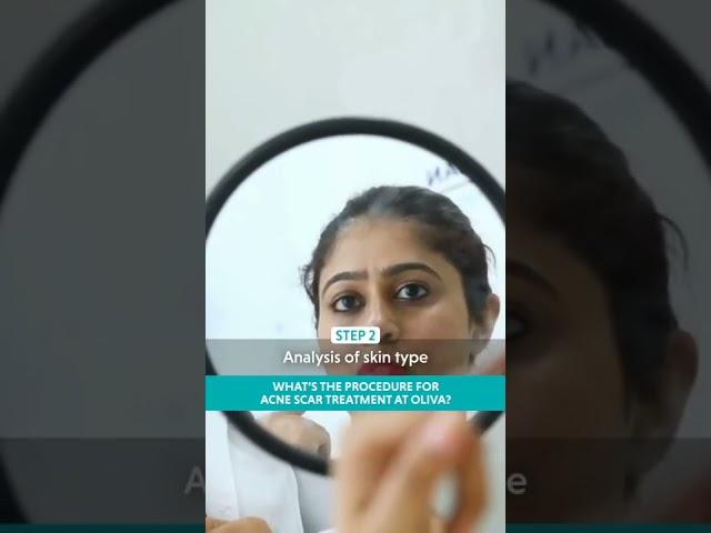 Here is a step-by-step description of acne scar treatment at Oliva