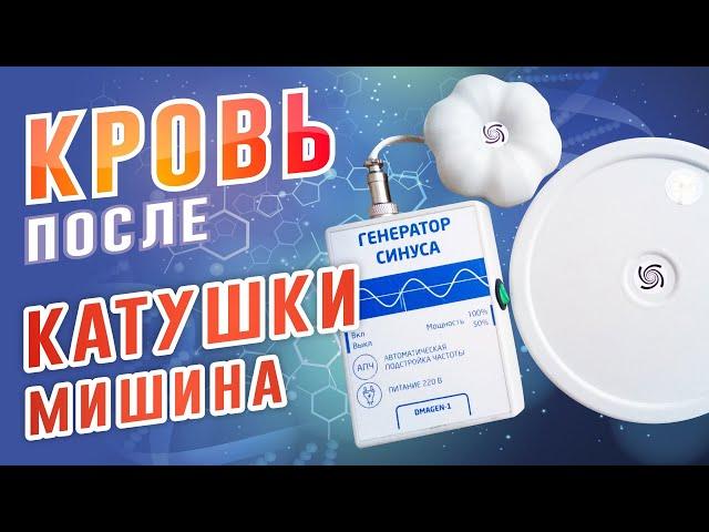 Катушка Мишина, что это? Как повлияла на кровь?