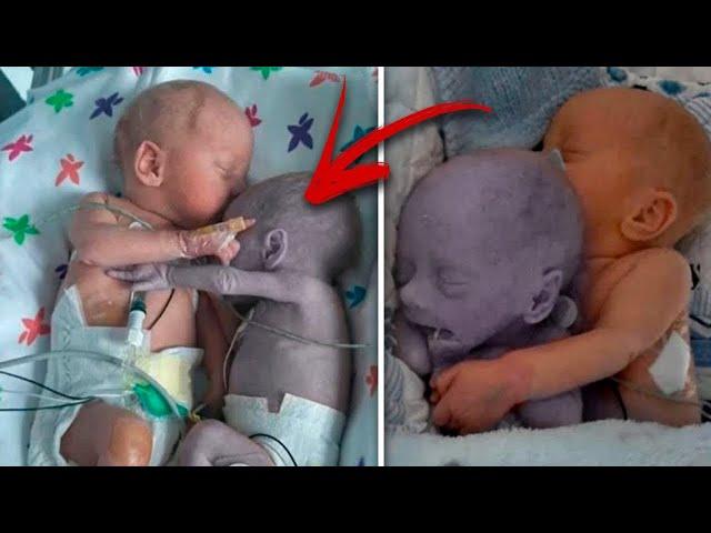 Mom puts the baby on her dying little brother  and five minutes later  a miracle happens...# warm h