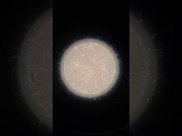 Sperm under a microscope