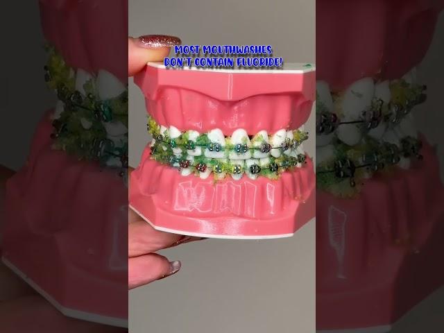 HOW TO FLOSS AND BRUSH YOUR TEETH WITH BRACES / BRACES JOURNEY TIPS  🪥
