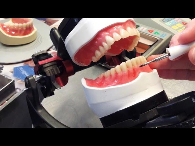 Characterized Denture Wax Up