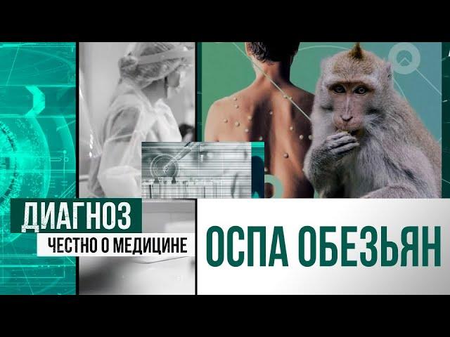 Оспа обезьян: новая пандемия или вирус для хайпа? | Диагноз