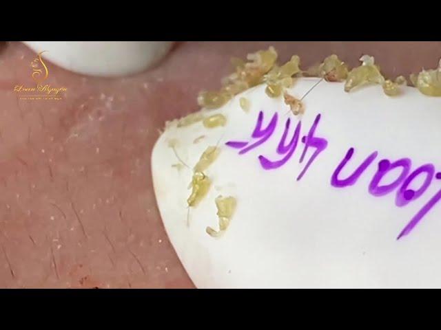 Satisfying With Loan Nguyen Spa Video #045