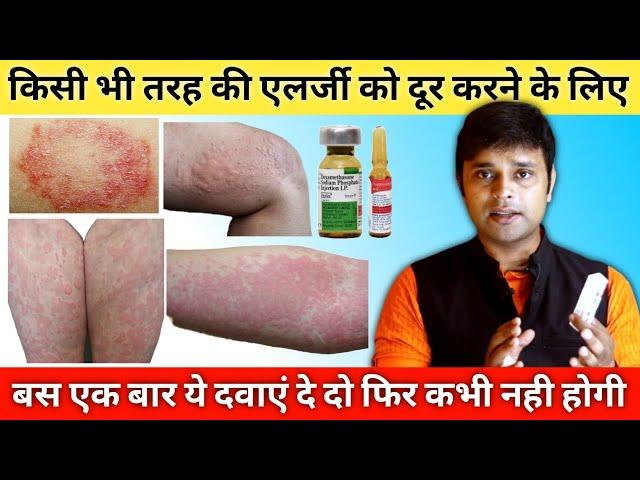 Best medicines for allergy treatment | Treatment of Urticaria | हर तरह की एलर्जी की दवा | inj dexona