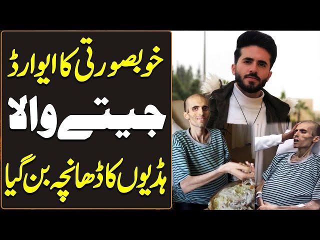 Before & After | Tragic Life Story of Ayman Ali Jordan | Haqeeqat Jano