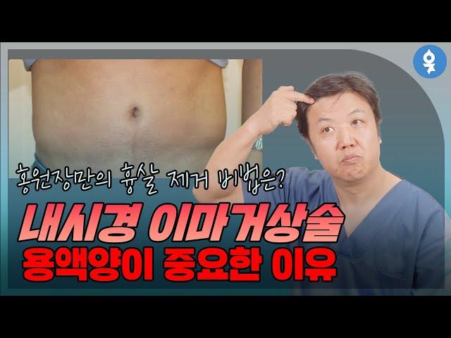 내시경 이마거상술 용액양이 중요한 이유