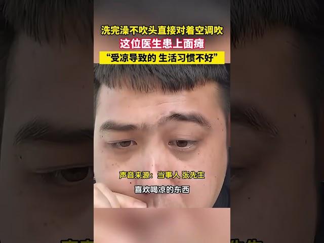 醫生洗頭后直接吹空調，導致面癱。他用親身體驗提醒大家：夏天不要過于貪涼。