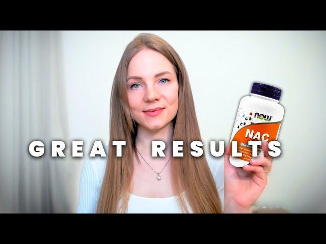 I used NAC supplement for 1 year with incredible benefits - how NAC works OCD, liver, migraine PT1