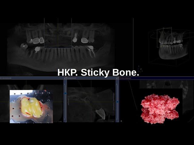 НКР. Sticky Bone.