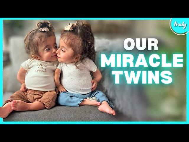 Our 4-Year-Old Twins Have Broken Hundreds Of Bones | BORN DIFFERENT