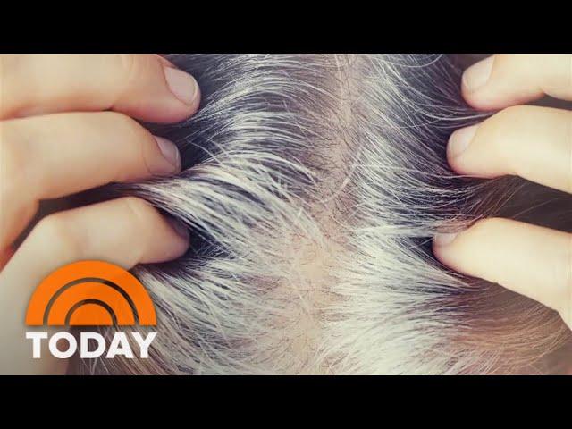 Do anti-gray hair products really work?